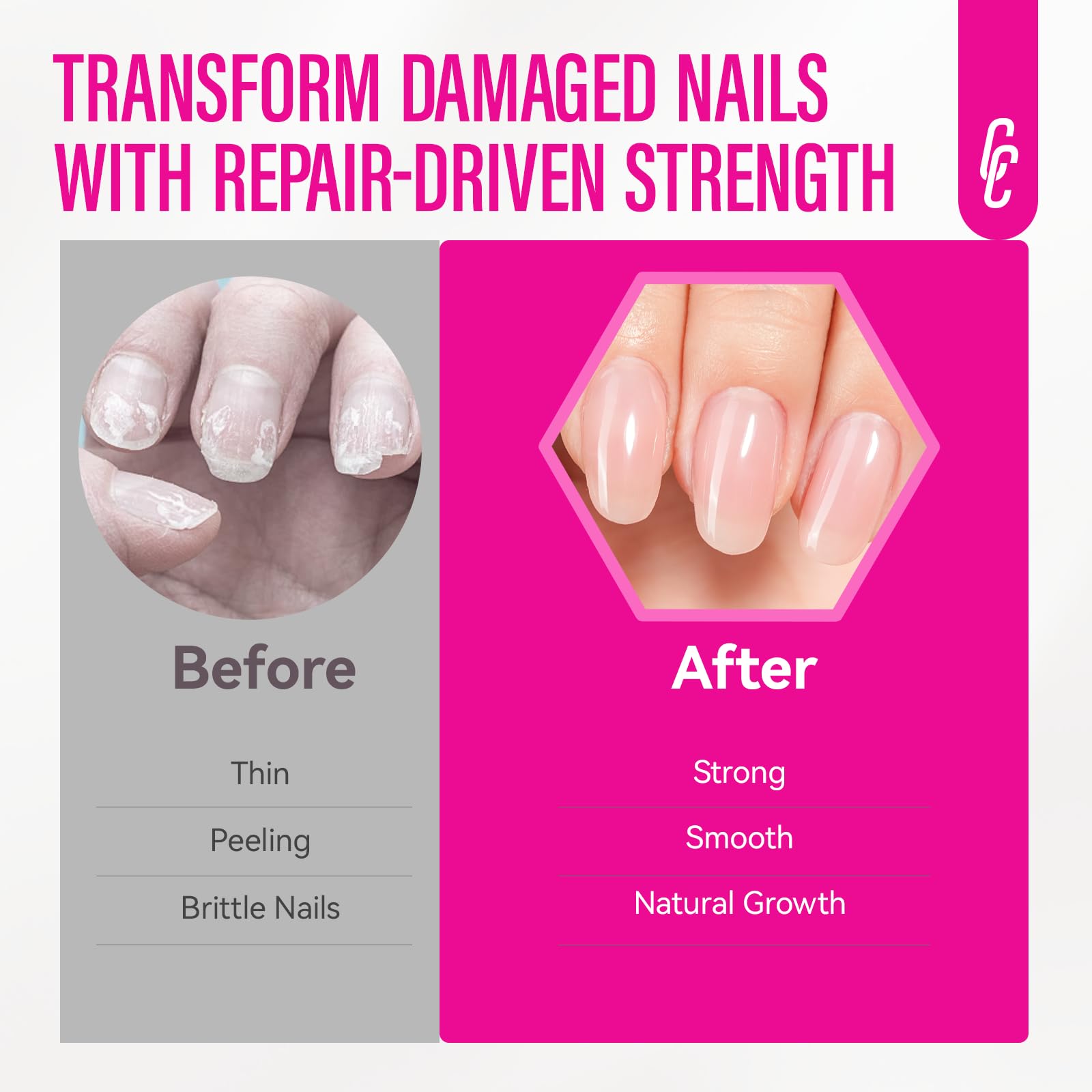 Nail Repair for Women: 8 in 1 Soft Pink Nail Hardener Strengthener